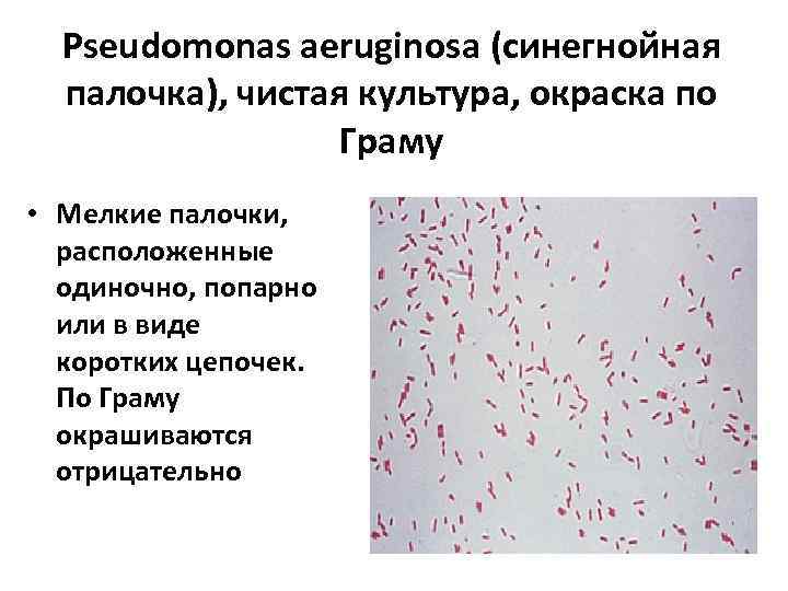 Бактерия синегнойная палочка
