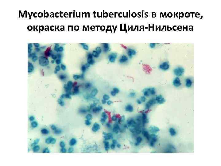 Мокрота на микобактерии