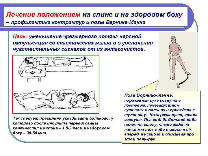 Лечение положением на спине и на здоровом боку  – профилактика контрактур и позы