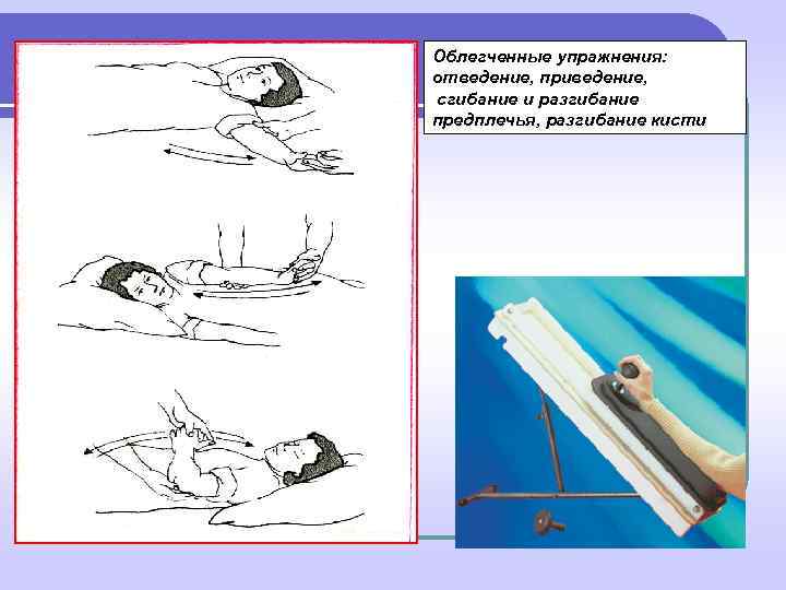 Облегченные упражнения:  отведение, приведение,  сгибание и разгибание предплечья, разгибание кисти 