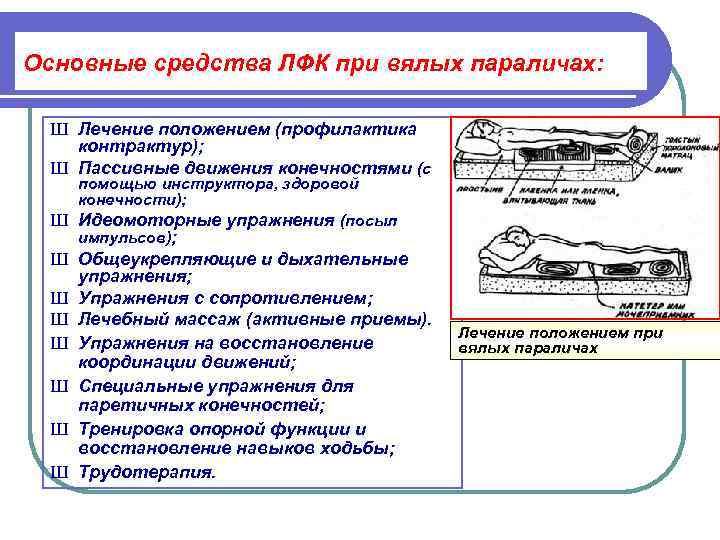 Основные средства ЛФК при вялых параличах:  Ш Лечение положением (профилактика контрактур);  Ш
