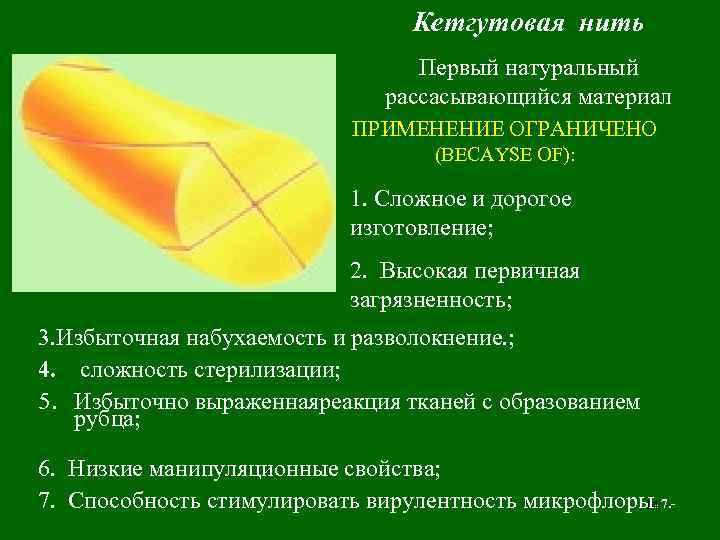        Кетгутовая нить     