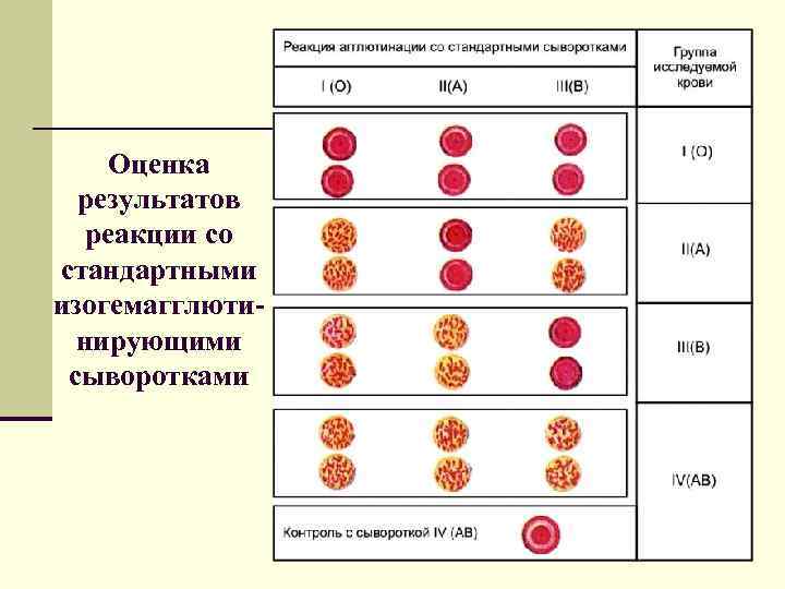   Оценка  результатов  реакции со стандартными изогемагглюти-  нирующими сыворотками 