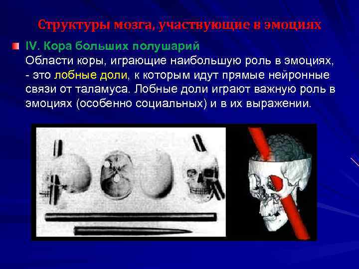  Структуры мозга, участвующие в эмоциях IV. Кора больших полушарий Области коры, играющие наибольшую