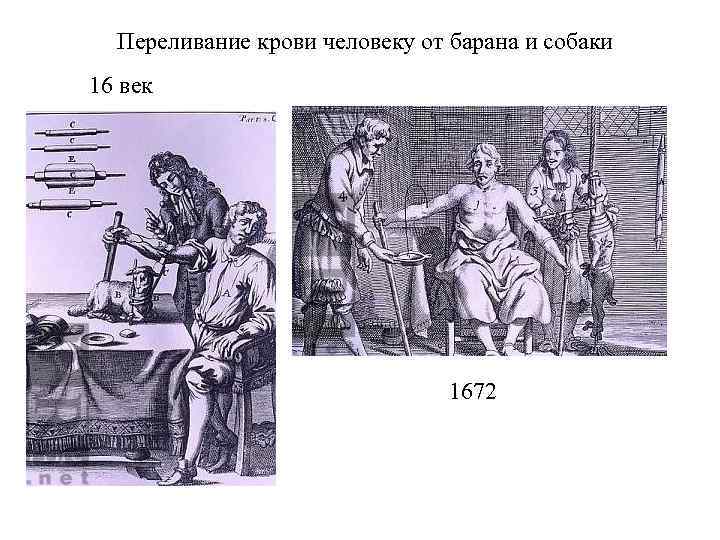  Переливание крови человеку от барана и собаки 16 век    