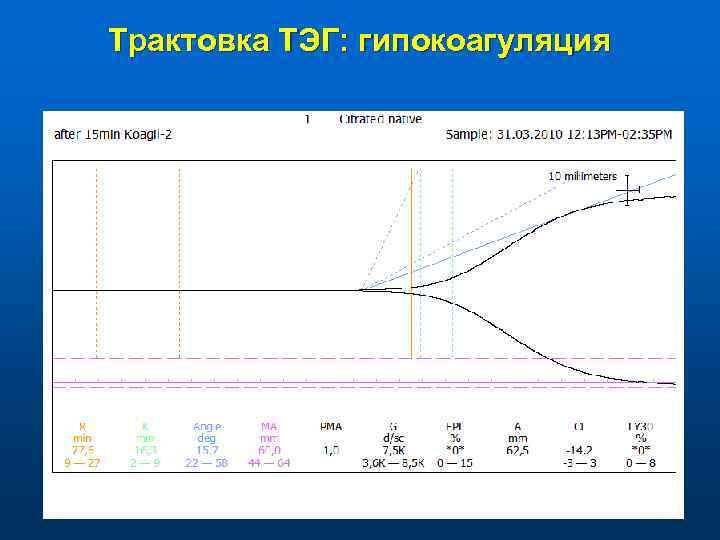 Трактовка ТЭГ: гипокоагуляция 