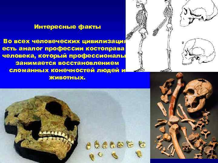   Интересные факты Во всех человеческих цивилизациях есть аналог профессии костоправа — человека,