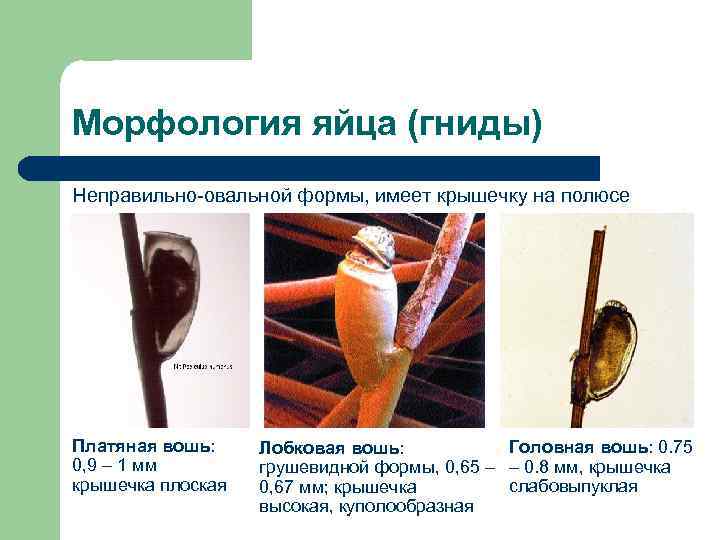 Морфология яйца (гниды) Неправильно-овальной формы, имеет крышечку на полюсе Платяная вошь: Лобковая вошь: 