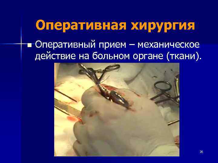   Оперативная хирургия n  Оперативный прием – механическое действие на больном органе