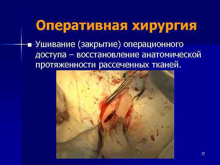   Оперативная хирургия n  Ушивание (закрытие) операционного доступа – восстановление анатомической протяженности