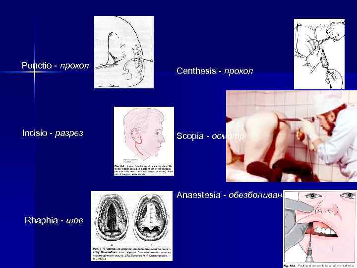 Punctio - прокол    Centhesis - прокол Incisio - разрез  Scopia