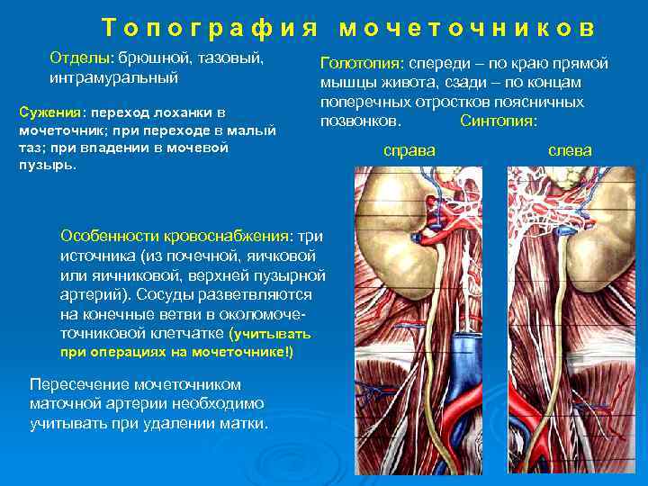    Топография мочеточников  Отделы: брюшной, тазовый,  Голотопия: спереди – по