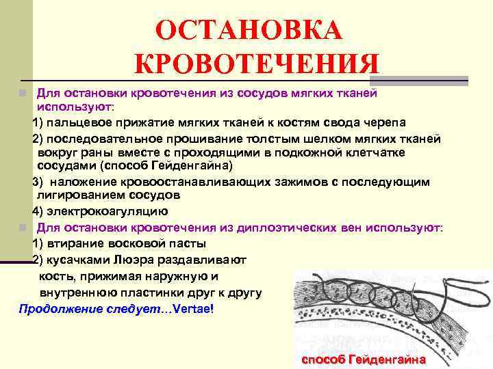    ОСТАНОВКА   КРОВОТЕЧЕНИЯ n Для остановки кровотечения из сосудов мягких