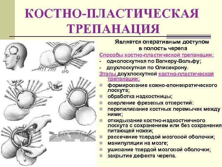 КОСТНО-ПЛАСТИЧЕСКАЯ ТРЕПАНАЦИЯ   Является оперативным доступом     в полость черепа