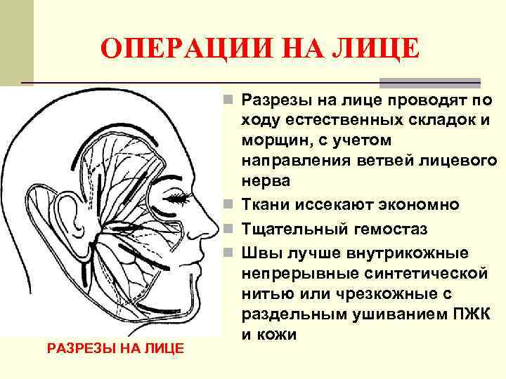  ОПЕРАЦИИ НА ЛИЦЕ    n Разрезы на лице проводят по 