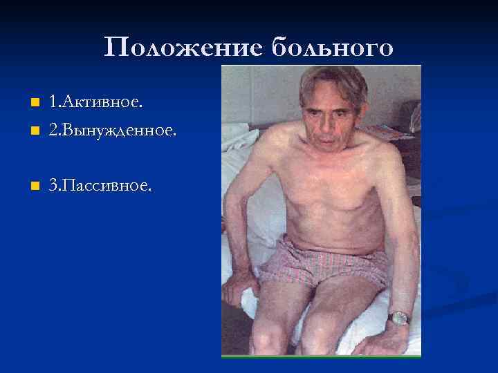    Положение больного n  1. Активное. n  2. Вынужденное. 