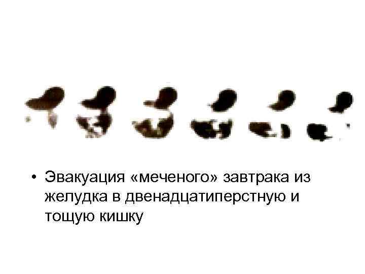 • Эвакуация «меченого» завтрака из желудка в двенадцатиперстную и тощую кишку • Эвакуация «меченого» завтрака из желудка в двенадцатиперстную и тощую кишку