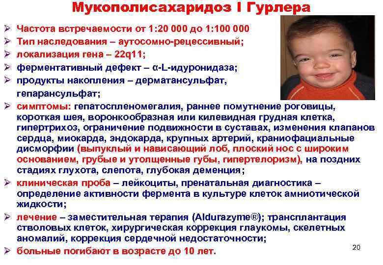    Мукополисахаридоз I Гурлера Ø  Частота встречаемости от 1: 20 000