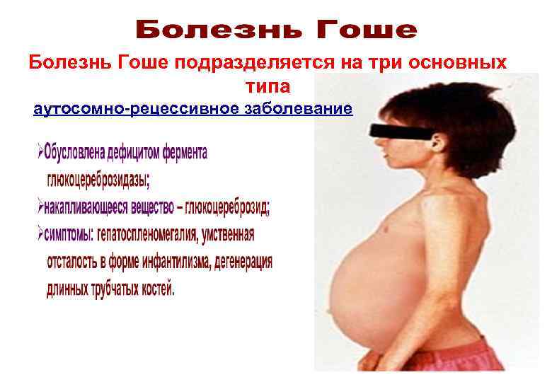 Болезнь Гоше подразделяется на три основных     типа аутосомно-рецессивное заболевание 