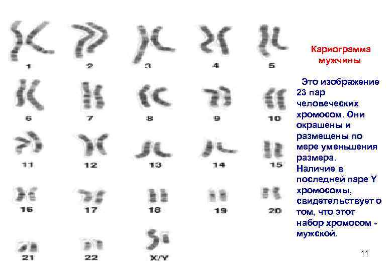   Кариограмма мужчины Это изображение 23 пар человеческих хромосом. Они окрашены и размещены