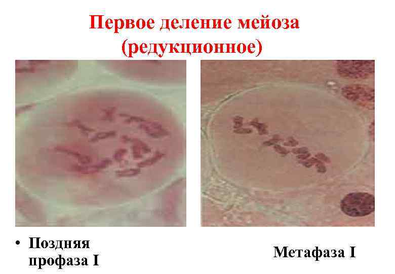    Первое деление мейоза   (редукционное) • Поздняя   