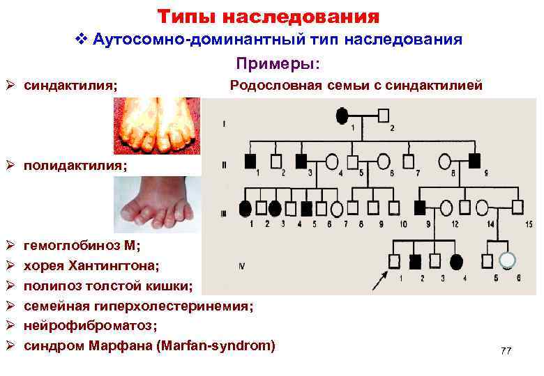     Типы наследования  v Аутосомно-доминантный тип наследования   