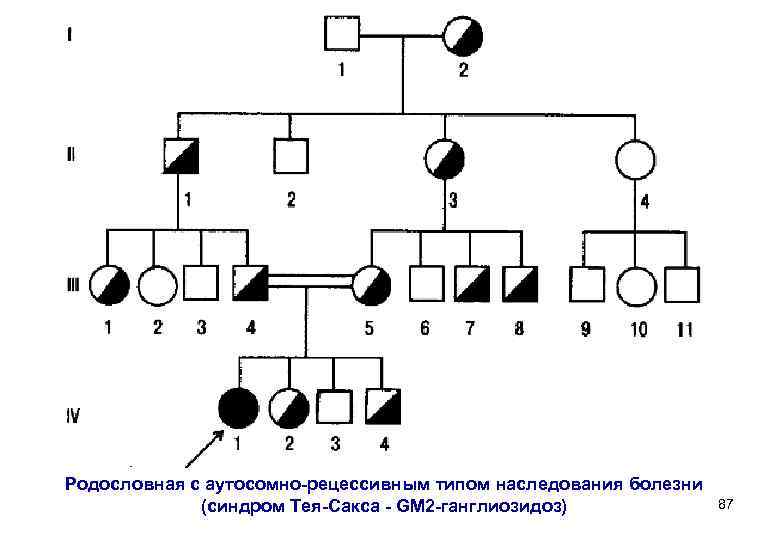 Родословная с аутосомно-рецессивным типом наследования болезни    (синдром Тея-Сакса - GМ 2