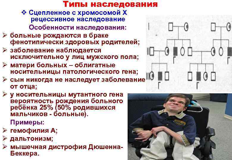    Типы наследования  v Сцепленное с хромосомой Х  рецессивное наследование