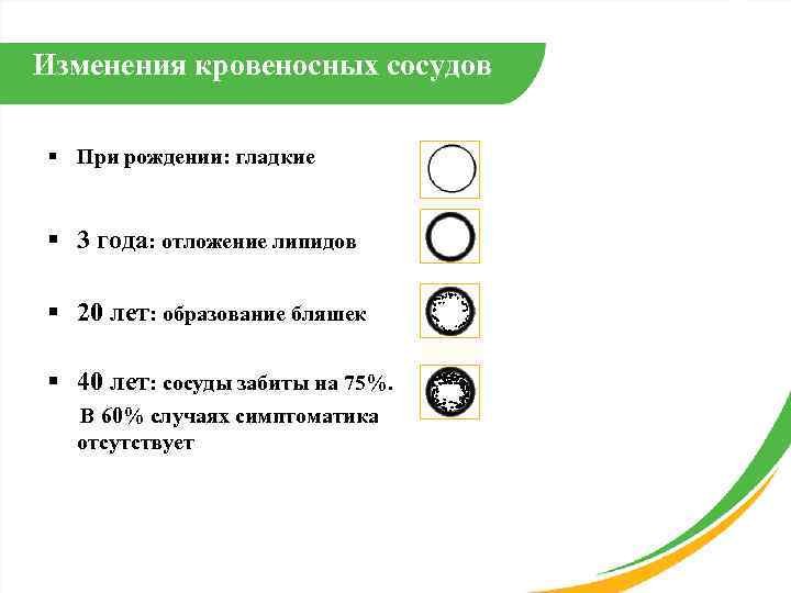 Изменения кровеносных сосудов § При рождении: гладкие  § 3 года: отложение липидов §