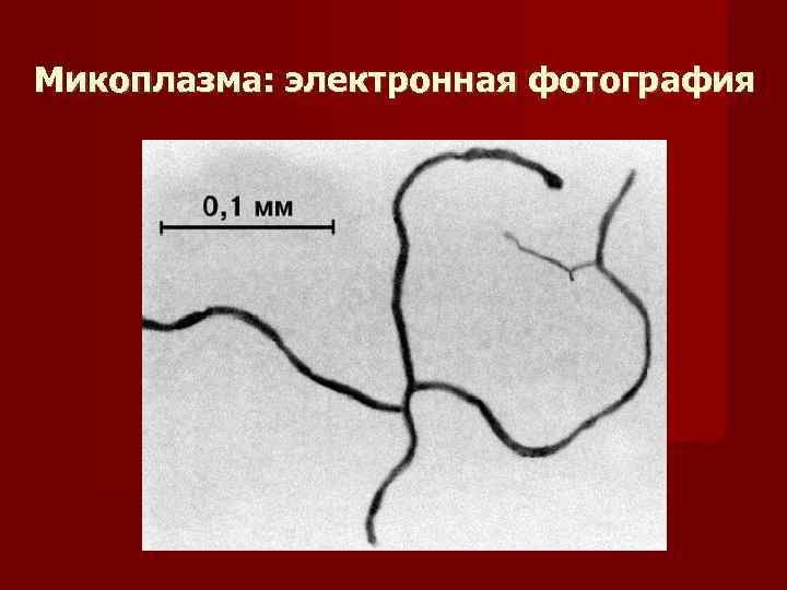 Микоплазма: электронная фотография 