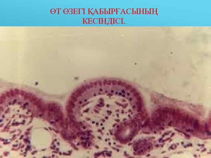 ӨТ ӨЗЕГІ ҚАБЫРҒАСЫНЫҢ   КЕСІНДІСІ. 