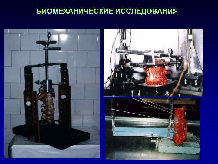 БИОМЕХАНИЧЕСКИЕ ИССЛЕДОВАНИЯ 