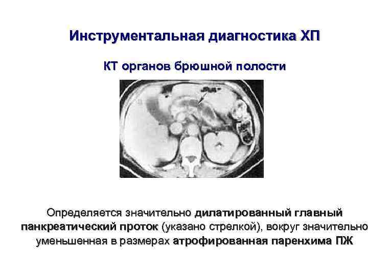   Инструментальная диагностика ХП    КТ органов брюшной полости  