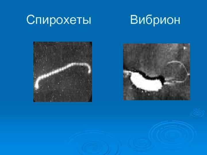 Спирохеты  Вибрион 
