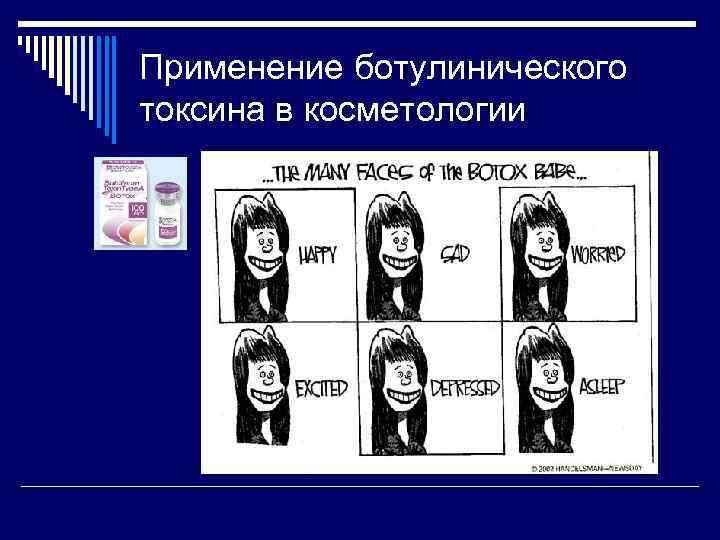 Применение ботулинического токсина в косметологии 