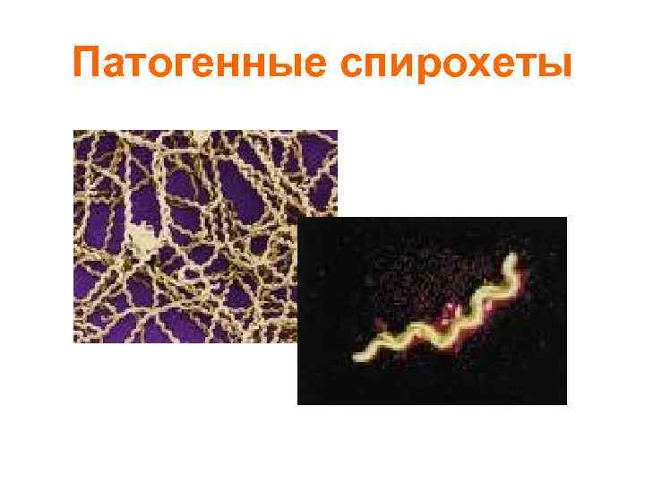 Патогенные спирохеты 