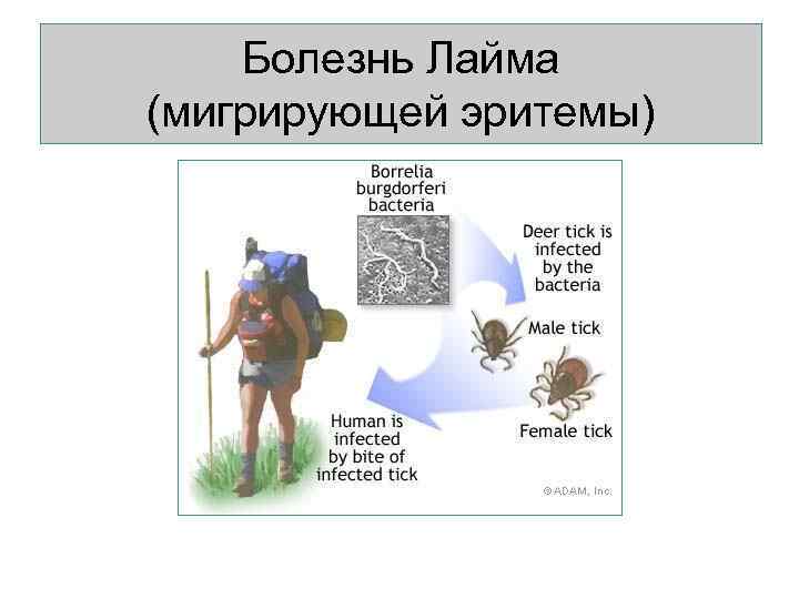   Болезнь Лайма (мигрирующей эритемы) 