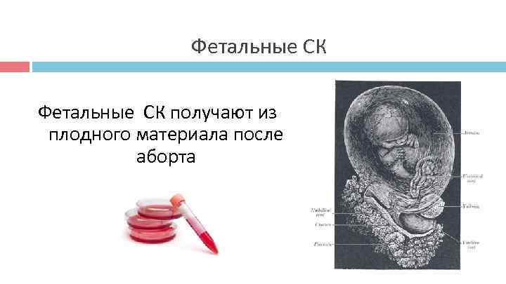 Фетальные СК получают из плодного материала после аборта Фетальные СК получают из плодного материала после аборта
