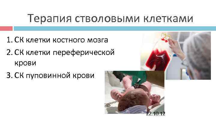 Терапия стволовыми клетками 1. СК клетки костного мозга 2. СК клетки переферической Терапия стволовыми клетками 1. СК клетки костного мозга 2. СК клетки переферической