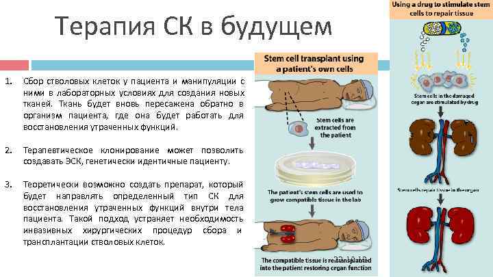 Терапия СК в будущем 1. Сбор стволовых клеток у пациента и Терапия СК в будущем 1. Сбор стволовых клеток у пациента и