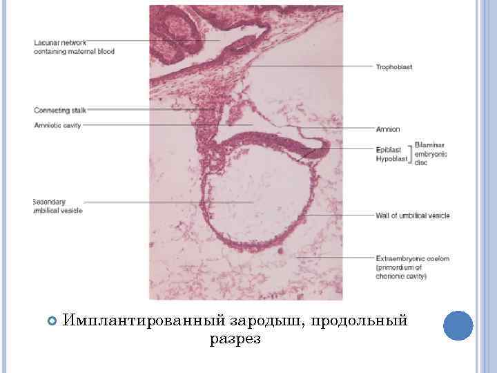   Имплантированный зародыш, продольный    разрез 