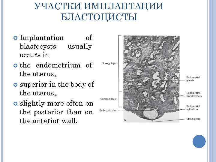  УЧАСТКИ ИМПЛАНТАЦИИ  БЛАСТОЦИСТЫ  Implantation  of  blastocysts  usually 