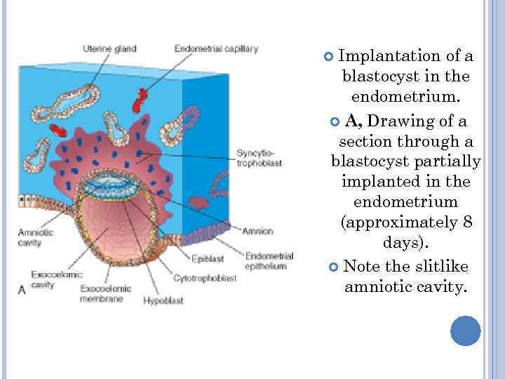  Implantation of a  blastocyst in the endometrium.  A, Drawing of a