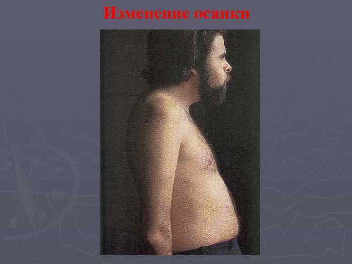 Изменение осанки 