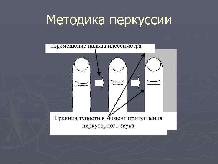 Методика перкуссии 