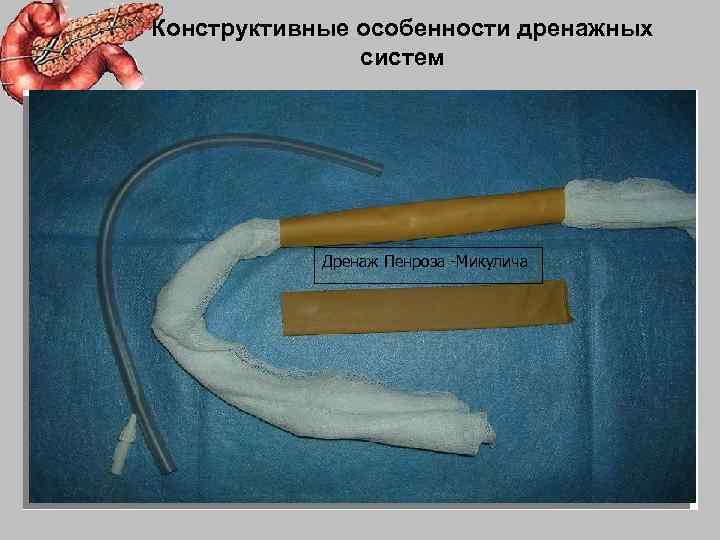 Конструктивные особенности дренажных    систем   Дренаж Пенроза -Микулича  