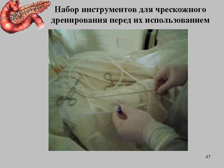  Набор инструментов для чрескожного дренирования перед их использованием    47 