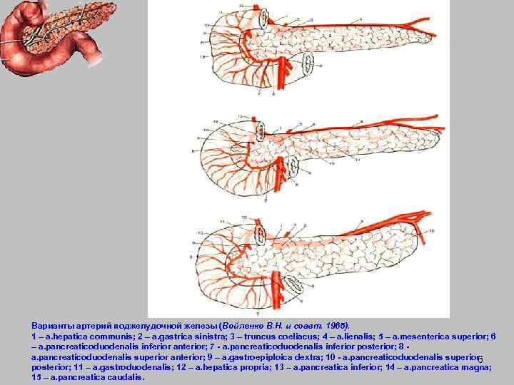Варианты артерий поджелудочной железы (Войленко В. Н. и соавт. 1965). 1 – a. hepatica
