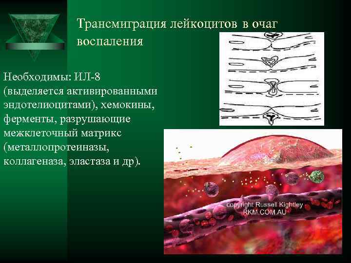    Трансмиграция лейкоцитов в очаг    воспаления Необходимы: ИЛ-8 (выделяется