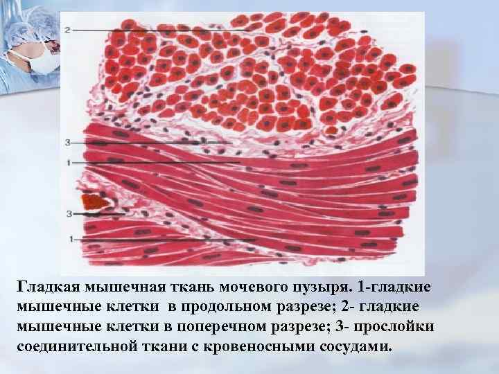 Гладкая мышечная ткань мочевого пузыря. 1 -гладкие мышечные клетки в продольном разрезе; 2 -